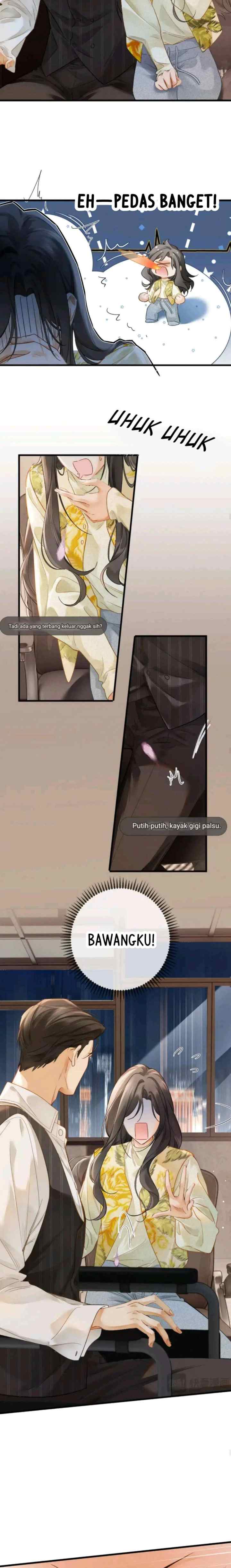 I Can't Escape From My Contract Husband's Doting Love chapter 3 halaman 11